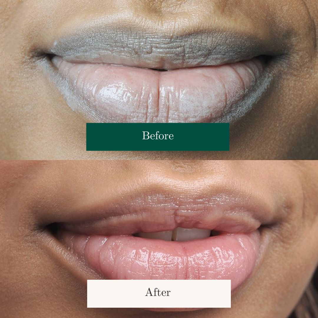 Before After 28